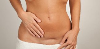 Il cesareo: come viene vissuto dalle gravide