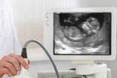 Osteopatia – Il piede torto nel neonato